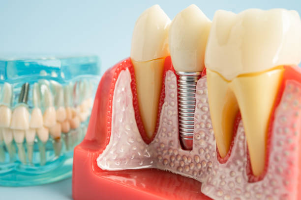 Oral Surgery in Mims, FL